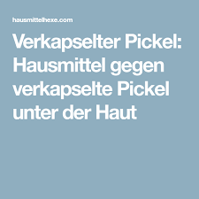Akne und pickel haben stets mehrere ursachen oder gehen auf ein zusammentreffen ungünstiger umstände zurück: Verkapselter Pickel Hausmittel Gegen Verkapselte Pickel Unter Der Haut Pure Ist Nicht Im Pimples Under The Skin Home Remedies For Pimples Skin Care Pimples
