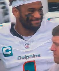 Tua's face, smiling after Houston recovered his fumble sack and scored a  touchdown. 🤷🏽‍♂️