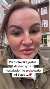 Urban Walk Featuring Unique Zebra-Striped Outfit