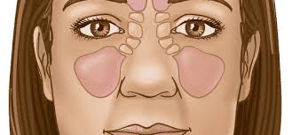 Like many other cancers, sinus and nasal cavity cancer may be linked to damage in the dna within your cells. Nose Sinus Cancer Thanc Guide