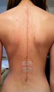 Pin On Surgeries Health
