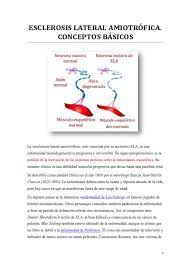 Su abordaje hace necesaria la articulación de actuaciones integrales, coordinadas y sinérgicas en los ámbitos social y sanitario. Esclerosis Lateral Amiotrofica Conceptos Basicos Pdf