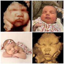 Babys Bungalow 3D/4D & HD-Live Ultrasound