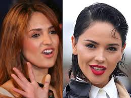 😊 Jesy Nelsons Tænder: Før og Efter