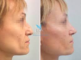 Dr. Maximo Alejandro Evia Arceo