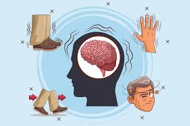 Parkinsons overview parkinson's disease affects the nerve cells in the brain that produce dopamine. Case Report Links Parkinson S Disease To Covid 19 Medpage Today