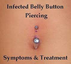 Infected Belly Piercing Not Pinning For Me Bc I Don T Have One But Maybe Someone Needs This Belly Button Rings Infected Belly Piercing Bellybutton Piercings