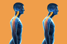 On the back of my neck, left side at the hairline, a small, hard lump appeared under the skin literally over night. The Best Ways To Fix Forward Head Posture Nerd Neck