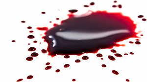 Other critics were more favorable, noting the album for its incorporation of genres jackson previously hadn't explored, justifying the use of previous themes but with brutal honesty. The Physics Of Blood Spatter Physics World