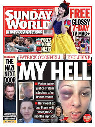 The mail on sunday is a british conservative newspaper, published in a tabloid format. Sunday World On Twitter This Week S Front Page My Hell Victim Claims Justice System Is Broken After Horror Her Violent Ex Joe Fraser Will Serve Just 22 Months In Prison