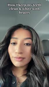 Teeth Whitening Tips with Braces and Sensodyne