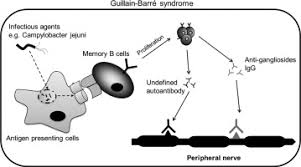 Doi:10.1038/nrneurol.2014.121 2) sejvar jj, baughman al. Memory B Cells In Guillain Barre Syndrome Journal Of Neuroimmunology