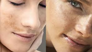 Pomada De La... - Farmacia De Especialidades - Dermatología | Facebook