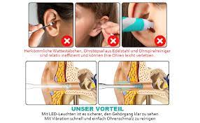Ohrenreiniger Bartun Ohrenschmalzentferner Ohrreiniger Mensch Mit Lichtern Und 4 Entfernbaren Silikon Aufsatzen Sicherer Und Weicher Ohrenschmalz Entferner Fur Kinder Und Erwachsene Amazon De Baby