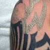 Each company decides its way of figuring out how to charge customers for tattoo removals. 3
