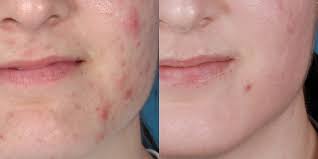 Zo® skin health provides a comprehensive range of solutions that will restore skin to a healthy state. Zo Skin Health Products Health And Aesthetics