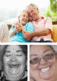Dental Implants in Los Alamitos, CA