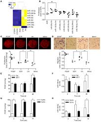 The result is two centrosomes, each with its own pair. Jci Microrna 140 5p And Smurf1 Regulate Pulmonary Arterial Hypertension