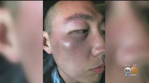 Hate Crimes Against Asian Americans Increase During Pandemic