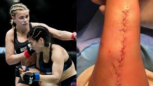 Here's to a speedy recovery. Ufc Star Paige Vanzant Posts Gruesome Surgery Images As She Goes Under The Knife Rt Sport News