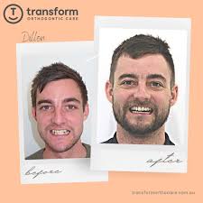 Adelaide's Leading Orthodontist