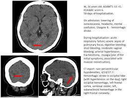 Image result for Plasmic Score