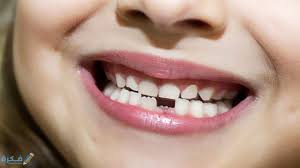 اذا كانت لديكم اسنان مسوسة فاقتلعوها فانها تؤتر على القلب. ØªÙØ³ÙŠØ± Ø­Ù„Ù… Ø±Ø¤ÙŠØ© Ø³Ù‚ÙˆØ· Ø§Ù„Ø§Ø³Ù†Ø§Ù† Ø¨Ø§Ù„ØªÙØµÙŠÙ„ Ù…ÙˆÙ‚Ø¹ ÙÙƒØ±Ø©