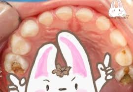 Search by image and photo. Tooth Bunny Fixing Tooth Cavities Cannot Cure Dental Decay