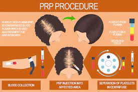 The most common cause of hair loss is a hereditary condition that happens with aging. Growth Factor Hair Loss Treatments Acell Hair Regrowth Treatments
