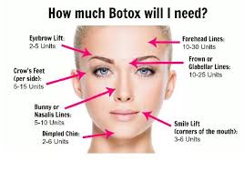 How much botox do i need for my forehead? How Much Botox Will I Need Acqua Blu Blog