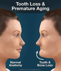 Dentaltown Where The Dental Community Lives Dental Facts Implant Dentist Dental Implants