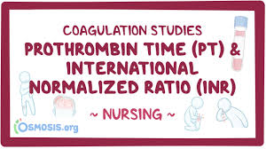 Image result for Prothrombin Time
