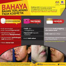 Nine11 (slot jom sihat) dr.alina membincangkan topik produk kosmetik beracun di segment jom sihat. Kementerian Kesihatan Malaysia Bahaya Bahan Terlarang Dalam Kosmetik Infografikkkm Facebook