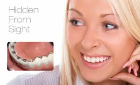 Do Any British Royals Currently Wear Braces (Orthodontic)? If So, Who And  Why? - Quora