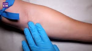 Image result for Peripheral IV Access