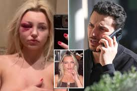 NYC plastic surgeon cuts back at sex slave claims by model ex, contends  Instagram posts show shes lying: court docs