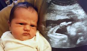 Baby Girl Ultrasound Scan Shocks Parents When She Does This Obscene Gesture Express Co Uk