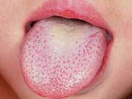 This infectious disease can be spread by saliva, and the incubation period for mono is four to eight weeks. Mononucleosi O Virus Dei Nuotatori I Sintomi E La Cura Swim4life Magazine