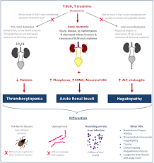 Image result for Postrenal Failure