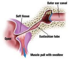 Image result for Inner Ear Decompression Sickness