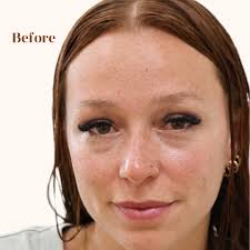 FM Beauty Clinic (@fmbeauty.studio) · Instagram 照片和视频