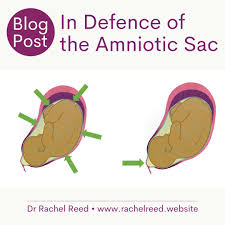 Leslie Cuffee -Professional Birth Doula Services