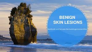 Skin cancer and precancerous changes in the skin are more serious causes of skin lesions. Benign Skin Lesions