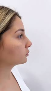 Dr. Alejandro Duarte (@dr.alejandroduarte) • Instagram photos and videos