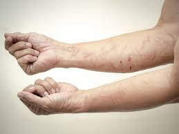 Check spelling or type a new query. Mengenal Self Harm Atau Menyakiti Diri Sendiri