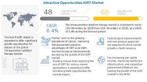 When malignant cancer cells form and grow within a person's breast tissue, breast cancer occurs. Intraoperative Radiation Therapy Market Global Forecast To 2025 Marketsandmarkets