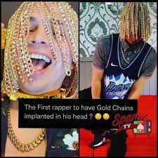 He said he had his gold and silver chains embedded into his head. An Artist Named Dan Sur Says He Has Hooks Embedded In His Head Which Allows The Gold Chains To Hang Cringetopia