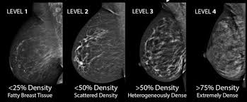 This condition usually does not develop a lump, but commonly affects the breast skin. Common Breast Cancer Types And Ultrasound Images Interpretation New Health Advisor