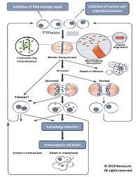 Was published in the lancet oncology. Novocure S Tumor Treating Fields Innovative Brain Cancer Therapy With Survival And Safety Benefits