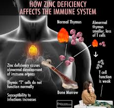 15 Zinc Deficiency Symptoms And Best Food Sources Drjockers Com Zinc Deficiency Zinc Deficiency Symptoms Immune Health